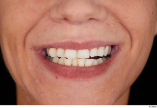 Sarah Kay teeth 0001.jpg